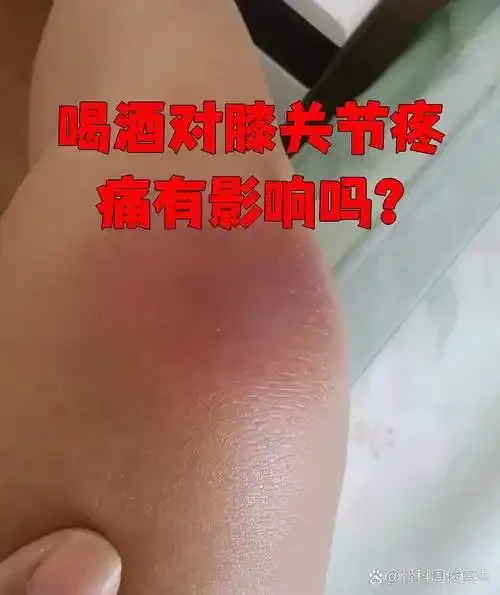 传统药酒泡制展示：桌上摊开的中医古籍与装有药材的透明药酒瓶_1